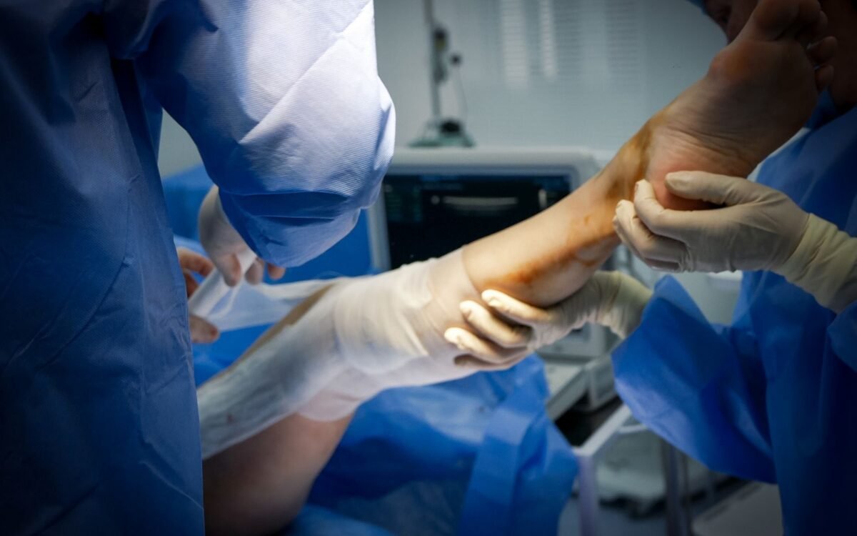 Timeline de recuperação do pós-operatório de rinomodelação cirúrgica em Minas Gerais, mostrando evolução semanal da redução de edema e equimoses