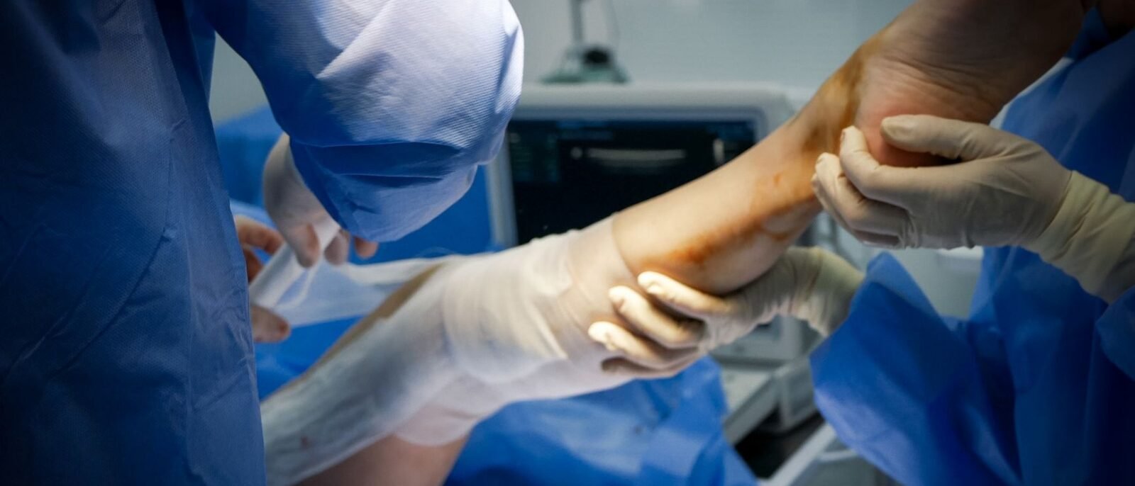 Timeline de recuperação do pós-operatório de rinomodelação cirúrgica em Minas Gerais, mostrando evolução semanal da redução de edema e equimoses