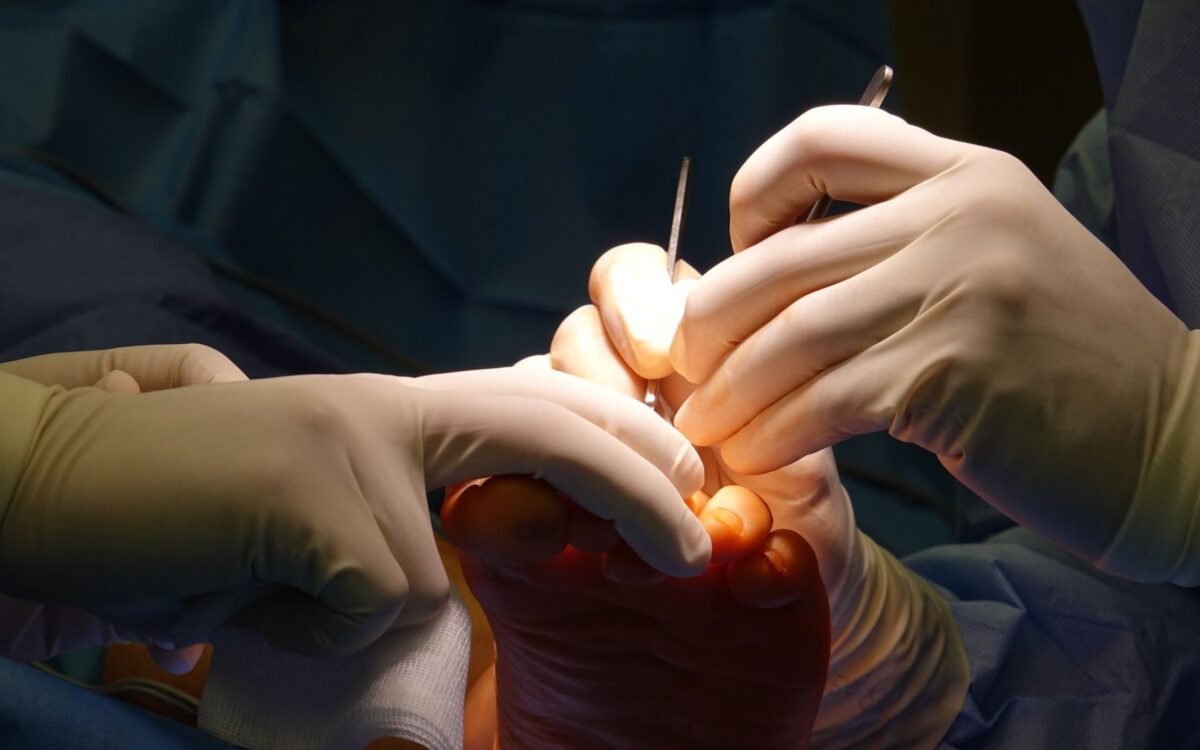 Mãos enluvadas realizando delicada cirurgia de pé em ambiente estéril de operação