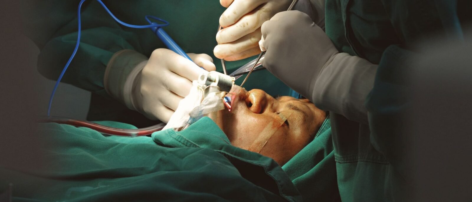 Cirurgiões em ambiente estéril realizando delicada cirurgia facial com instrumentos de precisão