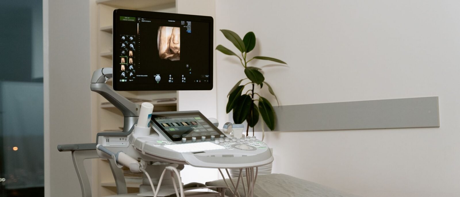 Equipamento de ultrassom de ponta em clínica de saúde para diagnóstico por imagem
